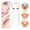 Limpiador Facial Ultrasónico Exfoliante Espinillas Belleza Blanco