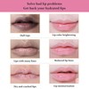KYDA 20 Pcs Moisturizing Lip Mask Set, Sleep Lip Mask
