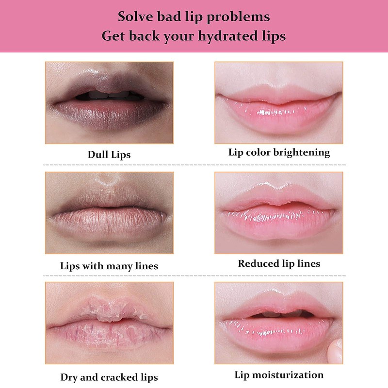 KYDA 20 Pcs Moisturizing Lip Mask Set, Sleep Lip Mask