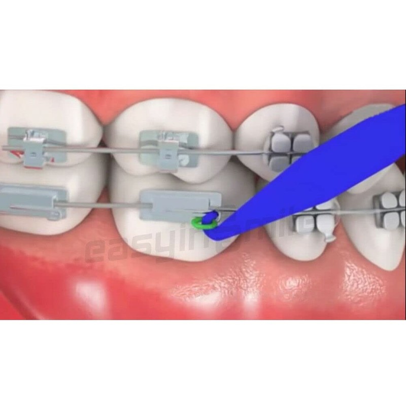 Dental Elastic Rubber Bands Placers for Braces, Disposable Plastic Orthodontic