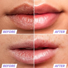 Wonderskin Lip Oil - Aceite De Suero De Rehabilitación De Labios, Suero Transparente Hidratante E Hidratante Para Labios Secos - Natural, Vegano Y No 