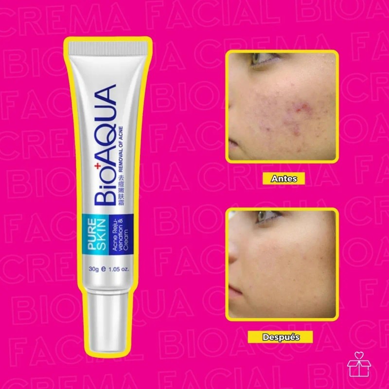 Crema Pure Skin Antiacné Controla Grasa Brotes 30g