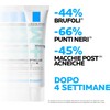 La Roche-Posay Effaclar DUO (+) M Crema hidratante anti-imperfecciones, 40ml