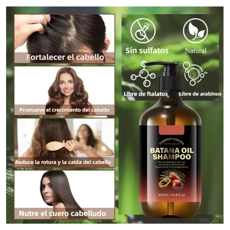 Shampoo Batana Oil Kit Pzs Shampoos 420ml Anticaida Tratamiento Capilar