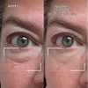 Dr.Brandt Gel desinflamante de ojos, 15 g