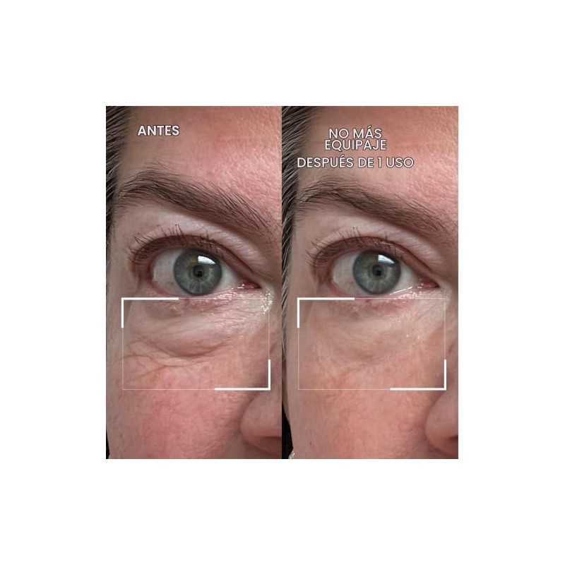 Dr.Brandt Gel desinflamante de ojos, 15 g