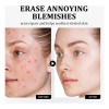 Crema Ácido Azelaico Niacinamida Vitamina