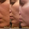 Crema rejuvenecedora de noche con tepezcohuite, retinol, y niacinamida -