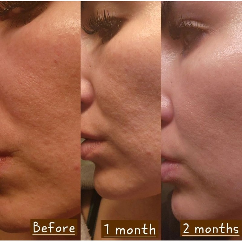 Crema rejuvenecedora de noche con tepezcohuite, retinol, y niacinamida -