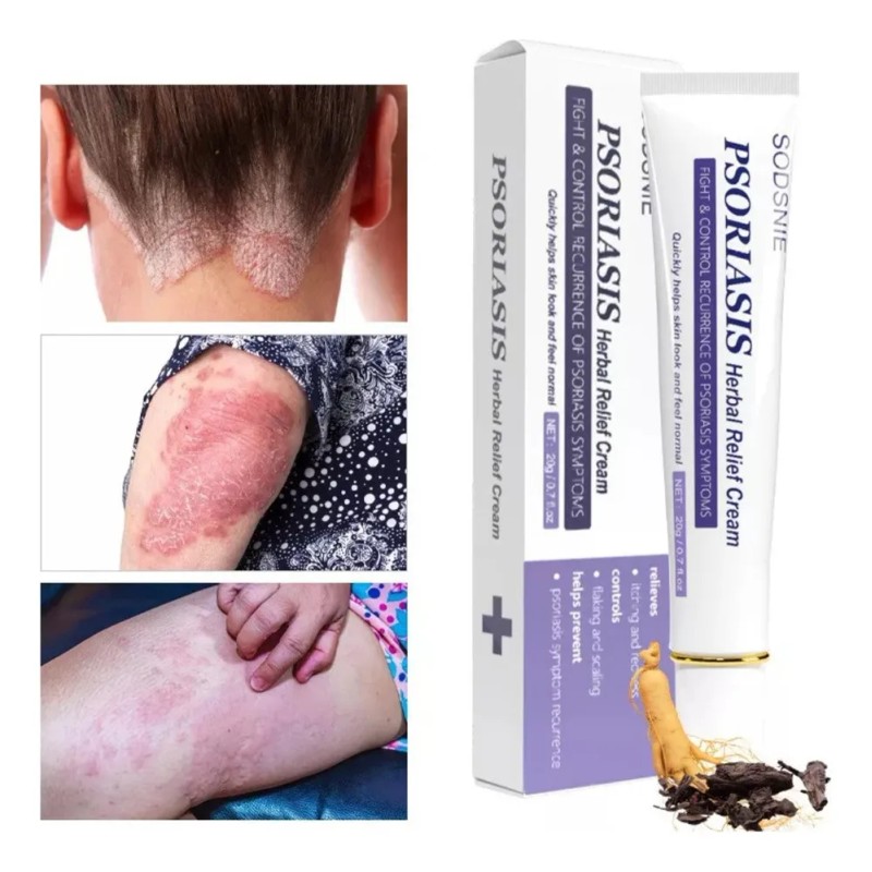 Crema F Para Psoriasis Y Cuidado De La Piel Ayurvédico