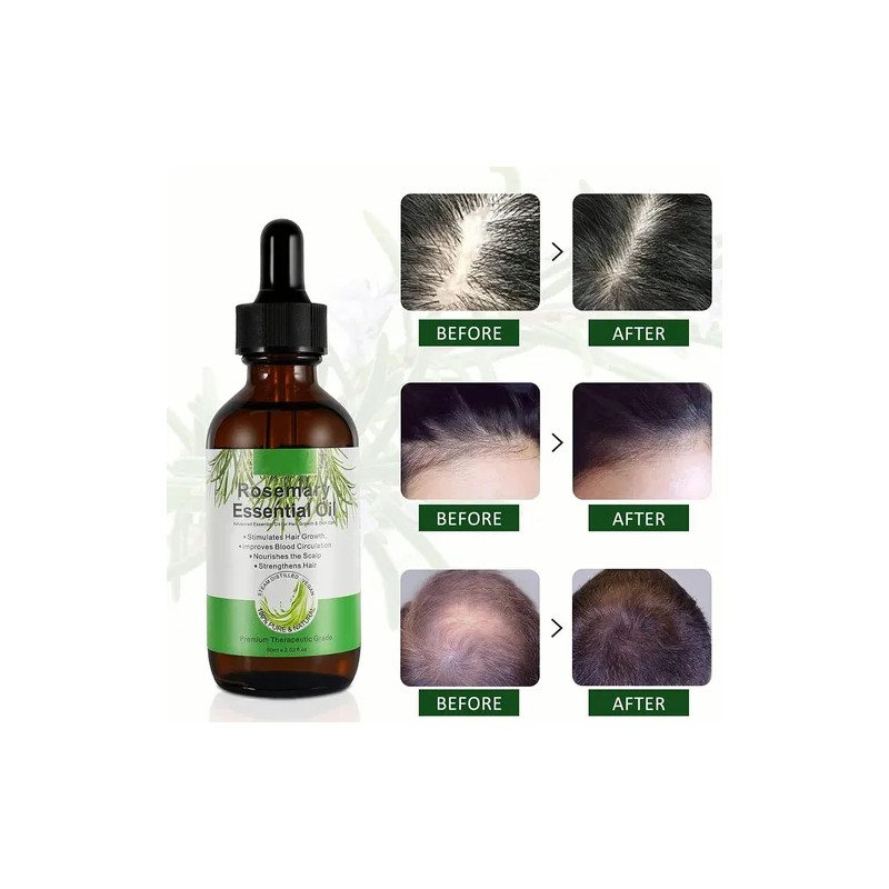 Sérum Capilar con Aceite de Romero 30ml – Crecimiento, Fortalecimiento