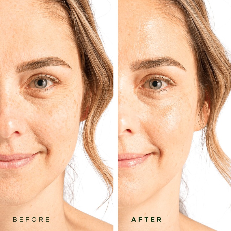 Flawless. Younger. Perfect. Hyaluronic Acid Serum for Skin - 2OZ