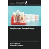 Implantes inmediatos