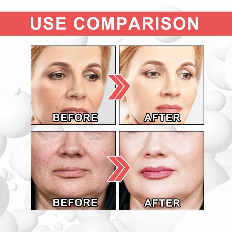 3Pcs EELHOE Collagen Boost Anti Aging Serum, EELHOE Anti-Wrinkle Cream,