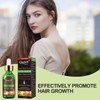 Anti-Hair Loss, Hair Growth Serum, Hair Loss and Hair Treatment,