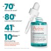 Avene Cleanance Sérum Exfoliante 30ml Tipo de piel Grasa Momento