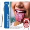 Tonsil Stone Remover Kit with Metal Case, Syringe and Tongue