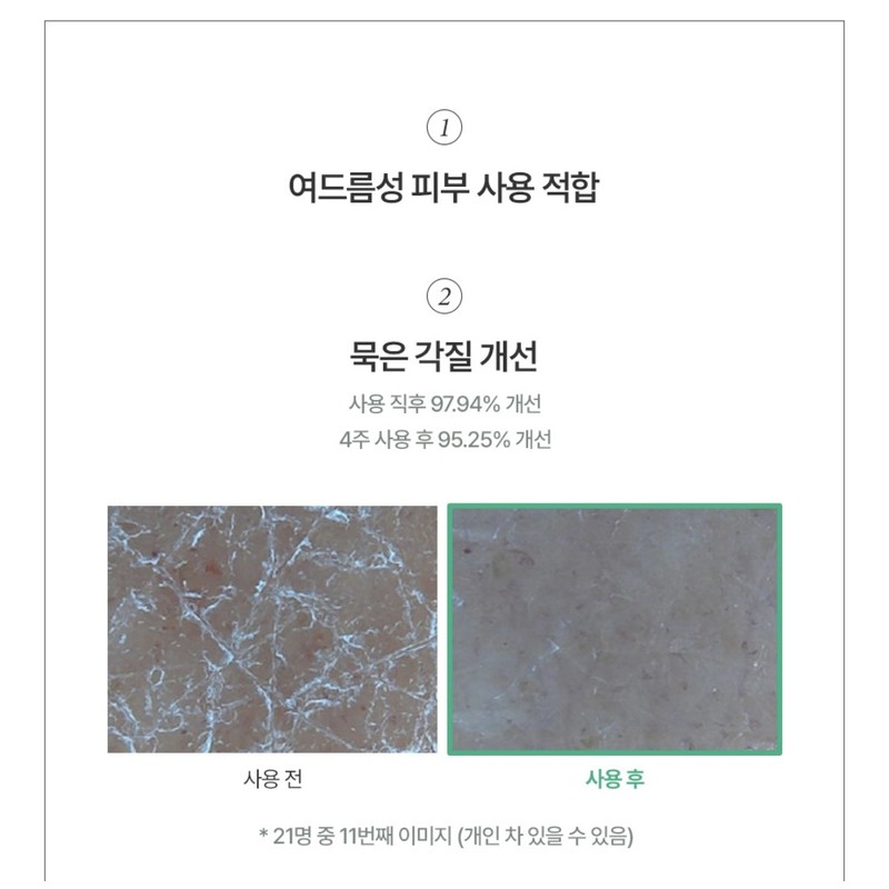 Beyond Acne Clear Body Wash 500ml / 비욘드 아크네 클리어
