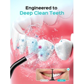 COSLUS Portable Water Flosser for Teeth: 10 Pressure Settings Professional Water Dental Pick for Orthodontic, Braces & Sensitive Gums - Cordless for Travel Use, for Adults Teens, BPA-Free, E40