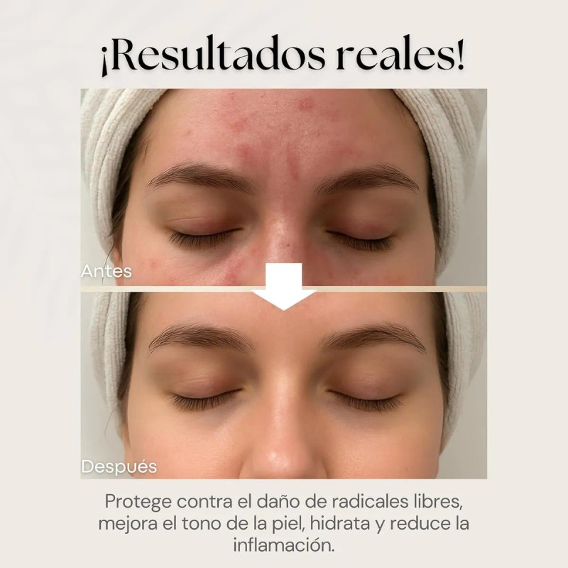 Sqin Luxiena Serum Baba De Caracol Coreano 96%, Mixta Día/noche