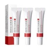 Crema para Manchas Oscuras en La Cara, Cremas para Quitar