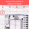 Yeanifeana ECG 7 regla de pasos, ECG 7 regla de
