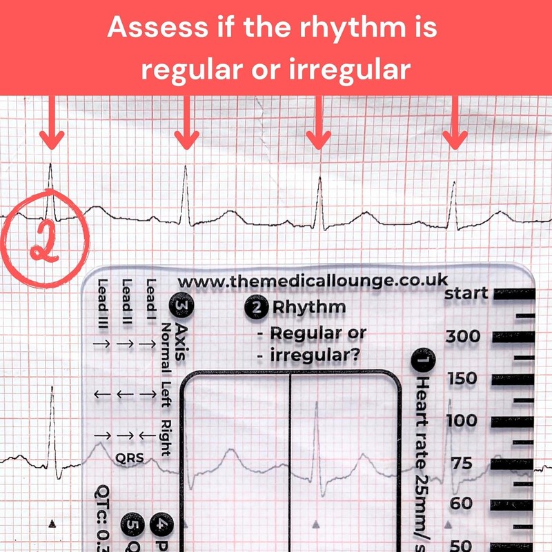 Yeanifeana ECG 7 regla de pasos, ECG 7 regla de
