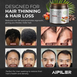 AIPILER Batana Oil with Caffeine for Men: Boost Hair Growth Support Healthy Scalp Roots and Follicles – Target DHT Seborrheic and Stress Hair Loss 5.3oz