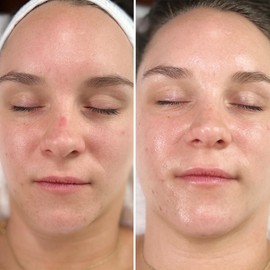 Intraceuticals Vitamin D3+ Booster