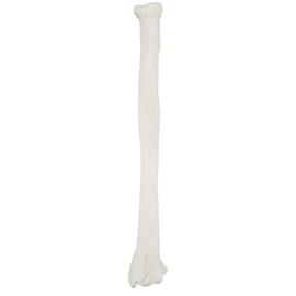 Axis Scientific Radius Bone Model | Left | Cast from a Real Human Radius Bone l Forearm Bone Model Has Realistic Texture and Important Bony Landmarks | Includes Product Manual | 3 Year Warranty