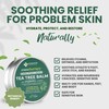 KESMEDIK Tea Tree Oil MaxTherapy Balm, Itchy Skin Relief, Soothing