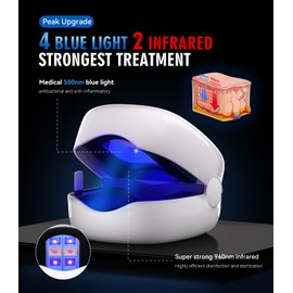 LOZLTX 2025 Nail Fungs Laer Device With Time Display 【 99% Fungus Gone in 3Min】Nail Fungus Laser Device【21-day Fast-acting】950nm Infrared Light 500nm Blue Light Pain-Free