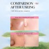 Limpiador Facial Limpiador Facial Limpiador 120 Ml