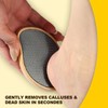 SG Nekoo Foot File Callus Remover for Feet, Pedicure Foot