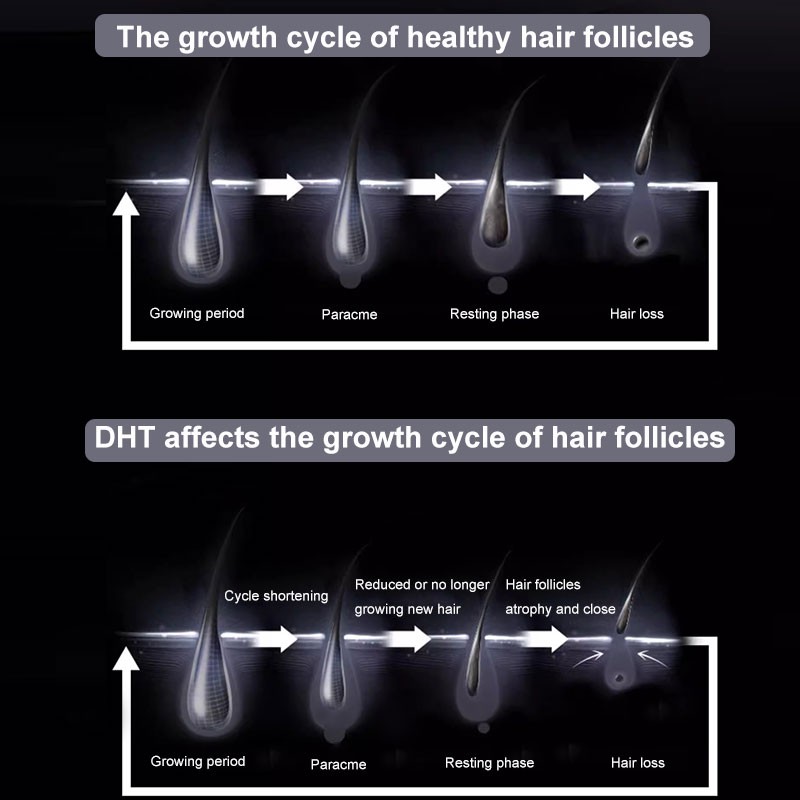 Alpecin Caffeine Shampoo 250ml For Prevent Hair Loss Strengthen Hair