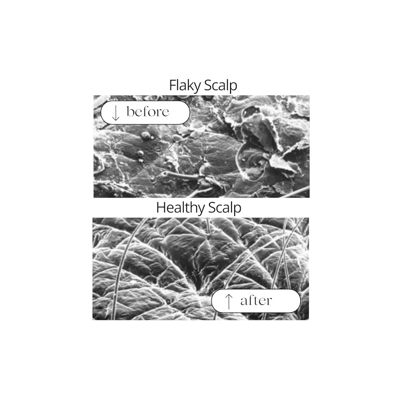 RAUSCH Coltsfoot Anti-Dandruff Shampoo 200 ml