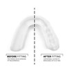 Sova 1.6mm Mouth Guard for Clenching and Grinding Teeth at