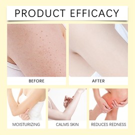 Cyperus Rotundus Oil,Cyperus Rotundus Oil for Hair Removal,Cyperus Oil Hair Removal,Cyperus Oil Natural,Moisturizing Cyperus Rotundus Oil for Reducing Body Hair Growth,Hair Removal Care Oil