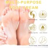 Honey Foot Cream for Cracked Heels & Dry Skin –Honey