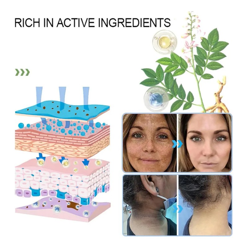 V V Gel Exfoliante Purificante Quarxery, Gel Exfoliante