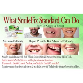 SmileFix Standard Dental Repair Kit - Color Matching Compound - For Missing Or Damaged Teeth - Fix Gaps, Broken Tooth, Spaces - Durable Repair - Fast & Easy - Confident Smiles