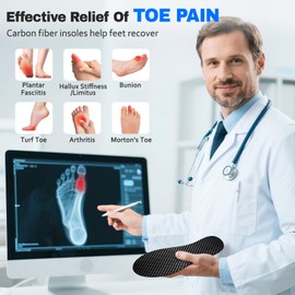Carbon Fiber Insole, 1 Pair, Rigid Shoe Insert for Arthritis, Turf Toe, Hallux Limitus, Hallux Rigidus, Foot Fractures, Mortons Neuroma Inserts, Alternative to Post Op Shoe 285mm