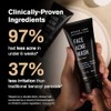 Shield System, Acne System for Men, Face Wash, Moisturizer, Pimple