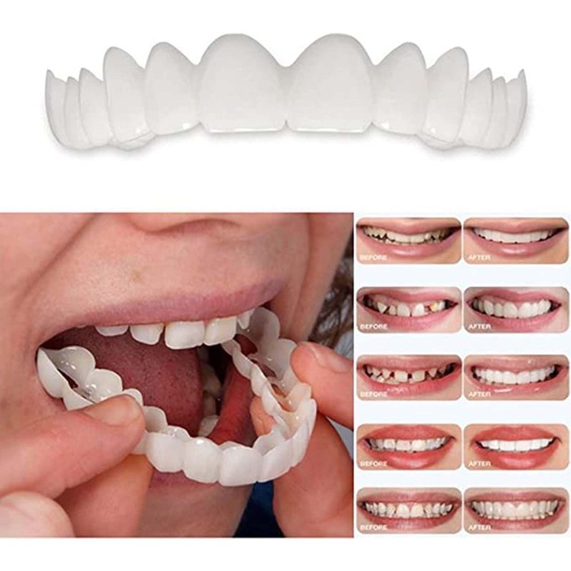 2PCS False Teeth - Unisex Snap-On Veneer - False Tooth