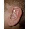 Acupressure Magnets Shelter In Place Hunger Control Acupressure Magnets One