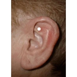 Acupressure Magnets Shelter In Place Hunger Control Acupressure Magnets One NEW Kit 2024 Success