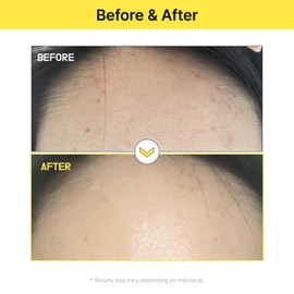 TIA'M Alpha-5 Mela Care Cream, 1.69 fl oz, 5% Alpha Arbutin Glow Enhancing Cream with Glutathione & Niacinamide, Korean Skin Care