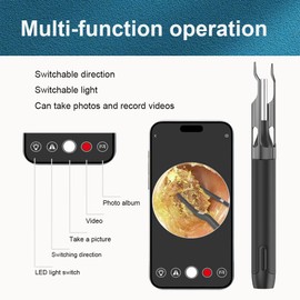Ear Wax Removal Tool Camera Ear Tweezers with Camera, Ear Camera Wax Removal, 10 Megapixels Ear Otoscope Camera, Ear Cleaner with Camera for Ear Cleaning (Black)