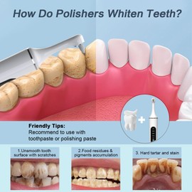 Tooth Polisher,Rechargeable Tooth Whitening Kit for Teeth Cleaning and Whitening, with 8 Brush Heads, LED Light, 5 Speed Modes Dental Polisher Personal Dental Care Kit for Home Use and Travel
