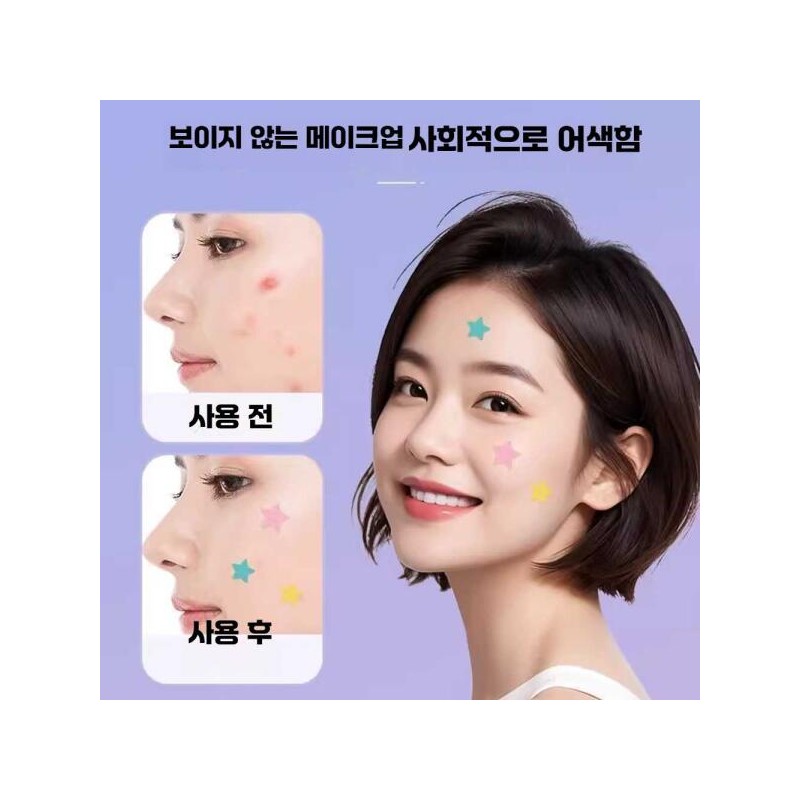 Unknown 노케이 별모양여드름패치 케어 트러블 별 스팟 패치 [핑크 40매